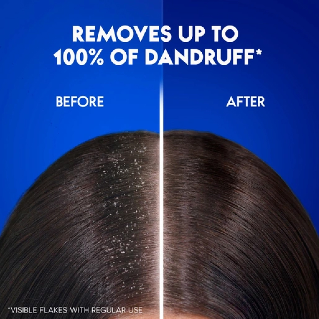 Head & Shoulders Apple Fresh Anti-Dandruff Shampoo 190ml